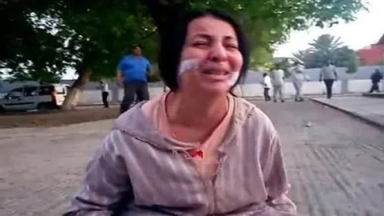 شهران حبسا نافذا مقابل وجه مشوه.. حكم قضائي يثير الجدل
