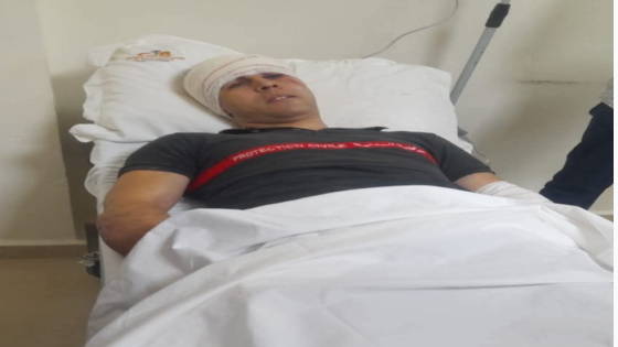 خبر مفرح : عنصر الوقاية المدنية المعتدى عليه في “شاطو” بني ملال بخير