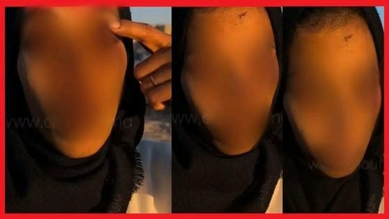 الدار البيضاء.. توقيف مشتبه فيه في اعتداء خلّف عاهة مستديمة