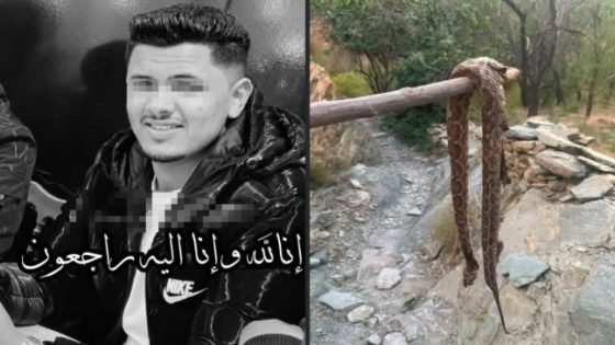 وفاة شاب بلدغة أفعى بالحوز