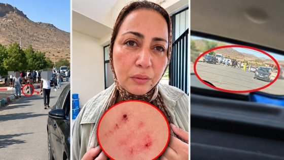 مطالب بفتح تحقيق في الاعتداء على الصحافية فاطمة الزهراء رجمي وطاقم «شوف تيفي»