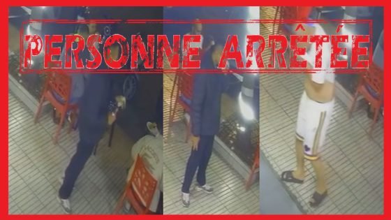 اعتقال متشرد خــ..در شخصا ثم رش على وجهه مادة حارقة