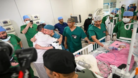السعودية.. نجاح عملية فصل توأم ملتصق مغربي بعد عملية دامت ست ساعات